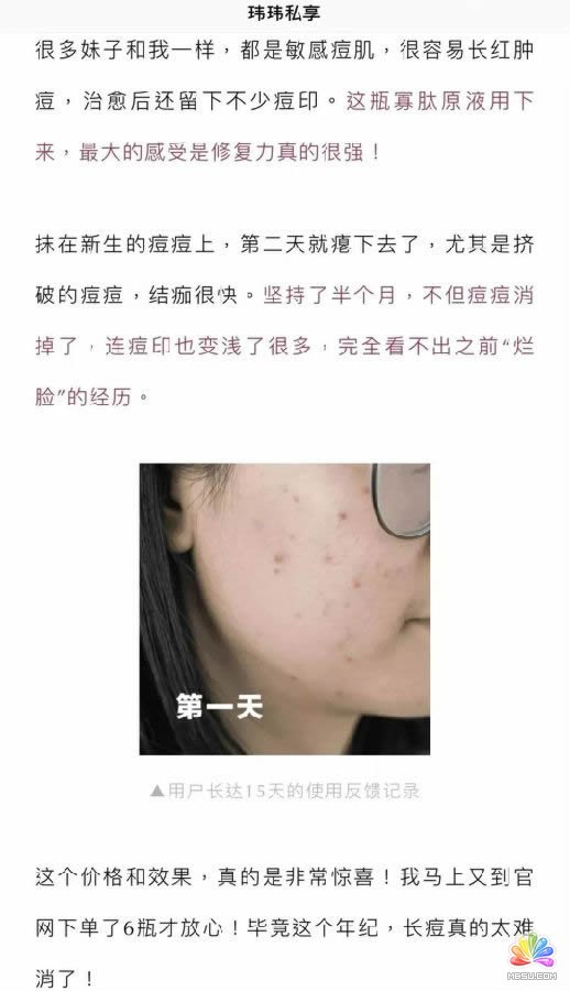 最全自媒體變現方式,3類8種方式告訴你怎么靠公眾號賺點錢 思考 心情感悟 自媒體 經驗心得 第9張